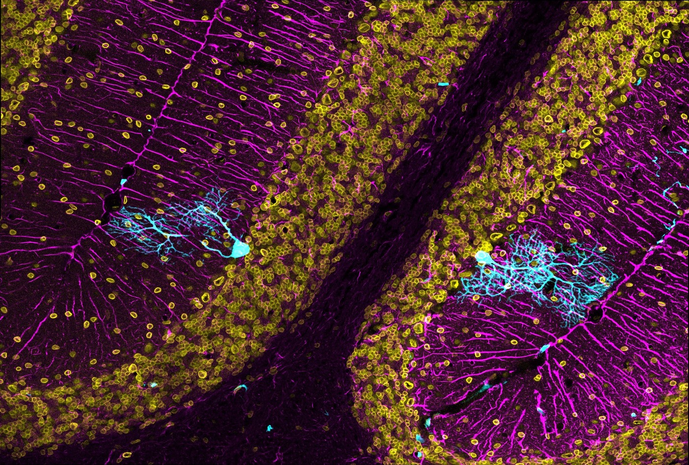 Recordando a Cajal para tratar la neurodegeneración