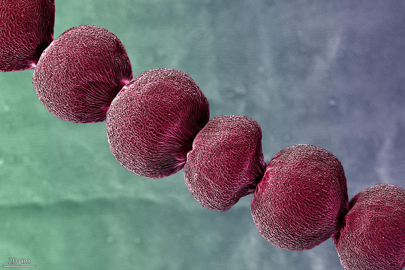 Biosensores