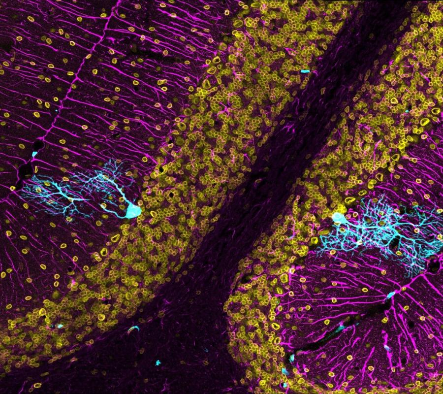 Recordando a Cajal para tratar la neurodegeneración