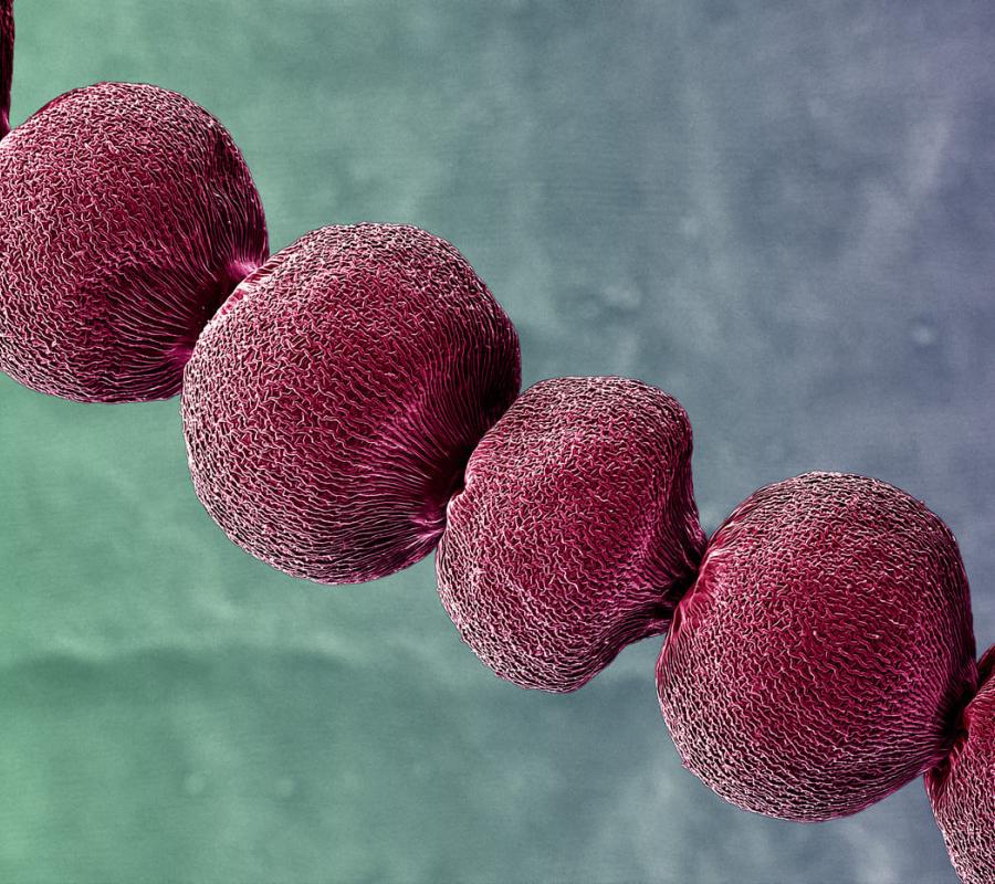 Biosensores