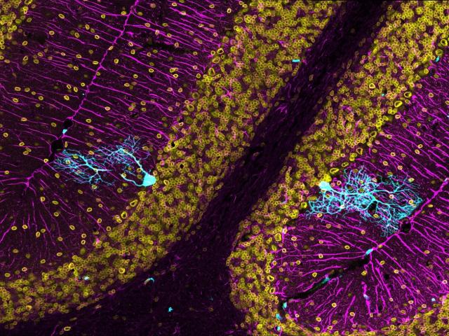 Recordando a Cajal para tratar la neurodegeneración / Pablo González Téllez de Meneses Recordando a Cajal para tratar la neurodegeneración